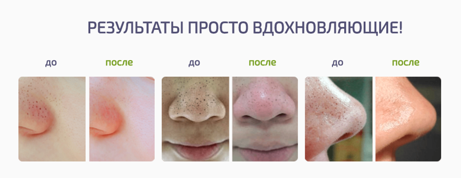 Спот Клинер заказать